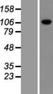Western Blot: Dnmt3a Overexpression Lysate (Adult Normal) [NBP2-05064] Left-Empty vector transfected control cell lysate (HEK293 cell lysate); Right -Over-expression Lysate for Dnmt3a.