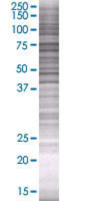 GUCY1A3 transfected lysate.