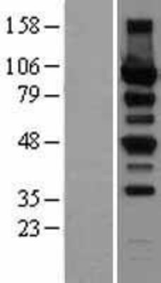 Western Blot: Protein Kinase D2 Overexpression Lysate (Adult Normal) [NBP2-08483] Left-Empty vector transfected control cell lysate (HEK293 cell lysate); Right -Over-expression Lysate for Protein Kinase D2.