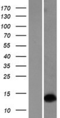 Western Blot: Dlx1 Overexpression Lysate (Adult Normal) [NBP2-08560] Left-Empty vector transfected control cell lysate (HEK293 cell lysate); Right -Over-expression Lysate for Dlx1.