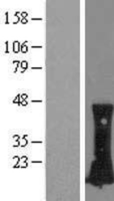 Western Blot: RhoC Overexpression Lysate (Adult Normal) [NBL1-15355] Left-Empty vector transfected control cell lysate (HEK293 cell lysate); Right -Over-expression Lysate for RhoC.