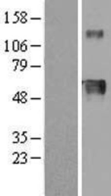 Western Blot: Hemopexin Overexpression Lysate (Adult Normal) [NBL1-11702] Left-Empty vector transfected control cell lysate (HEK293 cell lysate); Right -Over-expression Lysate for Hemopexin.