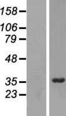 Western Blot: RRP7A Overexpression Lysate (Adult Normal) [NBL1-09135] Left-Empty vector transfected control cell lysate (HEK293 cell lysate); Right -Over-expression Lysate for RRP7A.