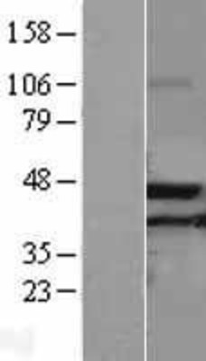 Western Blot: ACAA2 Overexpression Lysate (Adult Normal) [NBL1-07217] Left-Empty vector transfected control cell lysate (HEK293 cell lysate); Right -Over-expression Lysate for ACAA2.