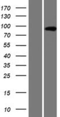 Western Blot: AMPD3 Overexpression Lysate (Adult Normal) [NBP2-08635] Left-Empty vector transfected control cell lysate (HEK293 cell lysate); Right -Over-expression Lysate for AMPD3.