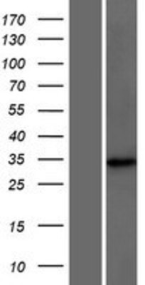 Western Blot: DCUN1D4 Overexpression Lysate (Adult Normal) [NBP2-08510] Left-Empty vector transfected control cell lysate (HEK293 cell lysate); Right -Over-expression Lysate for DCUN1D4.