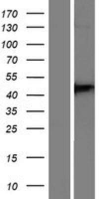 Western Blot: DPP6 Overexpression Lysate (Adult Normal) [NBP2-08568] Left-Empty vector transfected control cell lysate (HEK293 cell lysate); Right -Over-expression Lysate for DPP6.