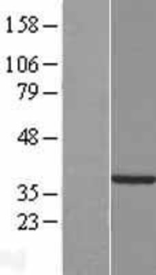 Western Blot: TYW5 Overexpression Lysate (Adult Normal) [NBP2-08544] Left-Empty vector transfected control cell lysate (HEK293 cell lysate); Right -Over-expression Lysate for TYW5.