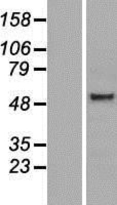 Western Blot: PSG6 Overexpression Lysate (Adult Normal) [NBP2-08595] Left-Empty vector transfected control cell lysate (HEK293 cell lysate); Right -Over-expression Lysate for PSG6.