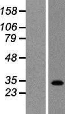 Western Blot: TGR5 Overexpression Lysate (Adult Normal) [NBP2-05211] Left-Empty vector transfected control cell lysate (HEK293 cell lysate); Right -Over-expression Lysate for TGR5.