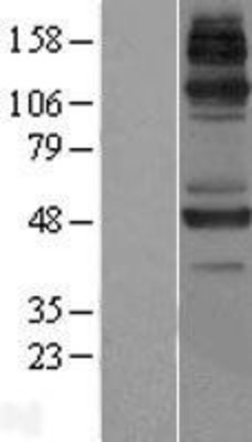 Western Blot: JMJD6 Overexpression Lysate (Adult Normal) [NBL1-12107] Left-Empty vector transfected control cell lysate (HEK293 cell lysate); Right -Over-expression Lysate for JMJD6.