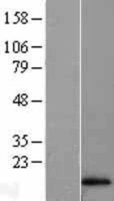 Western Blot: Hemoglobin A1 Overexpression Lysate (Adult Normal) [NBL1-11454] Left-Empty vector transfected control cell lysate (HEK293 cell lysate); Right -Over-expression Lysate for Hemoglobin A1.