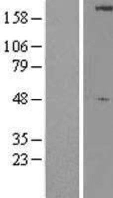 Western Blot: ULK1 Overexpression Lysate (Adult Normal) [NBL1-17607] Left-Empty vector transfected control cell lysate (HEK293 cell lysate); Right -Over-expression Lysate for ULK1.