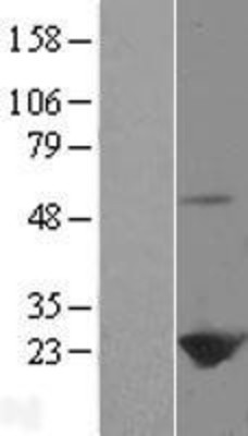 Western Blot: Peroxiredoxin 1 Overexpression Lysate (Adult Normal) [NBP2-04806] Left-Empty vector transfected control cell lysate (HEK293 cell lysate); Right -Over-expression Lysate for Peroxiredoxin 1.