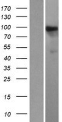 Western Blot: HIPK1 Overexpression Lysate (Adult Normal) [NBP2-04714] Left-Empty vector transfected control cell lysate (HEK293 cell lysate); Right -Over-expression Lysate for HIPK1.