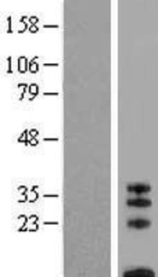 Western Blot: CD8 beta Overexpression Lysate (Adult Normal) [NBP2-05170] Left-Empty vector transfected control cell lysate (HEK293 cell lysate); Right -Over-expression Lysate for CD8 beta.