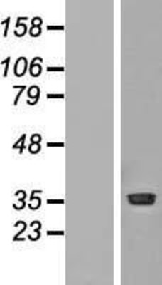 Western Blot: PRMT1 Overexpression Lysate (Adult Normal) [NBP2-04723] Left-Empty vector transfected control cell lysate (HEK293 cell lysate); Right -Over-expression Lysate for PRMT1.