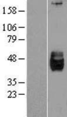 Western Blot: DKK3 Overexpression Lysate (Adult Normal) [NBL1-09903] Left-Empty vector transfected control cell lysate (HEK293 cell lysate); Right -Over-expression Lysate for DKK3.