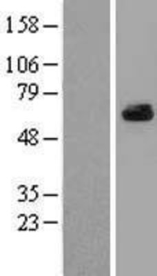 Western Blot: ARFGAP3 Overexpression Lysate (Adult Normal) [NBL1-07657] Left-Empty vector transfected control cell lysate (HEK293 cell lysate); Right -Over-expression Lysate for ARFGAP3.