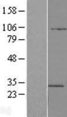 Western Blot: ATP6V1E2 Overexpression Lysate (Adult Normal) [NBL1-07844] Left-Empty vector transfected control cell lysate (HEK293 cell lysate); Right -Over-expression Lysate for ATP6V1E2.