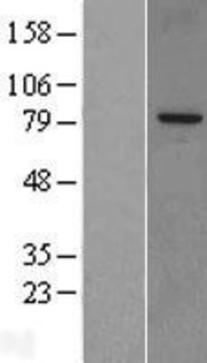 Western Blot: SnoN Overexpression Lysate (Adult Normal) [NBL1-15990] Left-Empty vector transfected control cell lysate (HEK293 cell lysate); Right -Over-expression Lysate for SnoN.