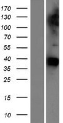 Western Blot: GAS1 Overexpression Lysate (Adult Normal) [NBP2-08152] Left-Empty vector transfected control cell lysate (HEK293 cell lysate); Right -Over-expression Lysate for GAS1.