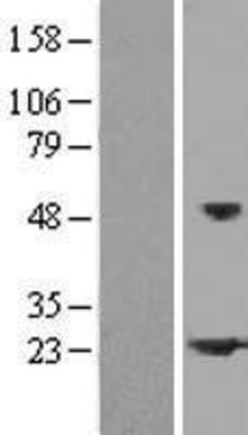 Western Blot: HspB2 Overexpression Lysate (Adult Normal) [NBP2-08193] Left-Empty vector transfected control cell lysate (HEK293 cell lysate); Right -Over-expression Lysate for HspB2.