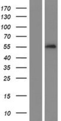 Western Blot: SERPINA10 Overexpression Lysate (Adult Normal) [NBP2-08261] Left-Empty vector transfected control cell lysate (HEK293 cell lysate); Right -Over-expression Lysate for SERPINA10.