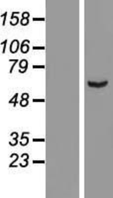 Western Blot: ARHGAP15 Overexpression Lysate (Adult Normal) [NBL1-07666] Left-Empty vector transfected control cell lysate (HEK293 cell lysate); Right -Over-expression Lysate for ARHGAP15.