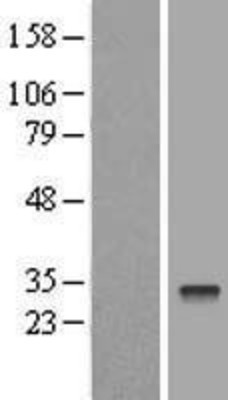 Western Blot: Proteasome 20S LMP7 Overexpression Lysate (Adult Normal) [NBL1-14883] Left-Empty vector transfected control cell lysate (HEK293 cell lysate); Right -Over-expression Lysate for Proteasome 20S LMP7.