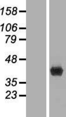 Western Blot: FBP1 Overexpression Lysate (Adult Normal) [NBL1-10611] Left-Empty vector transfected control cell lysate (HEK293 cell lysate); Right -Over-expression Lysate for FBP1.