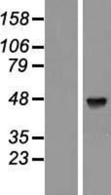 Western Blot: PABPC5 Overexpression Lysate (Adult Normal) [NBL1-14057] Left-Empty vector transfected control cell lysate (HEK293 cell lysate); Right -Over-expression Lysate for PABPC5.