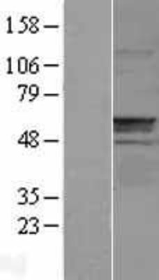 Western Blot: CNDP1 Overexpression Lysate (Adult Normal) [NBL1-09307] Left-Empty vector transfected control cell lysate (HEK293 cell lysate); Right -Over-expression Lysate for CNDP1.