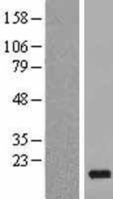 Western Blot: PDE6D Overexpression Lysate (Adult Normal) [NBL1-14228] Left-Empty vector transfected control cell lysate (HEK293 cell lysate); Right -Over-expression Lysate for PDE6D.