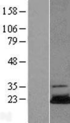 Western Blot: Ube2N Overexpression Lysate (Adult Normal) [NBL1-17541] Left-Empty vector transfected control cell lysate (HEK293 cell lysate); Right -Over-expression Lysate for Ube2N.