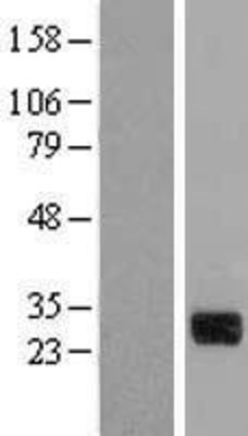 Western Blot: CTDSP1 Overexpression Lysate (Adult Normal) [NBL1-09567] Left-Empty vector transfected control cell lysate (HEK293 cell lysate); Right -Over-expression Lysate for CTDSP1.