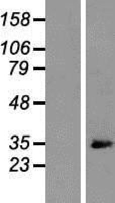 Western Blot: ARPC2 Overexpression Lysate (Adult Normal) [NBP2-05285] Left-Empty vector transfected control cell lysate (HEK293 cell lysate); Right -Over-expression Lysate for ARPC2.