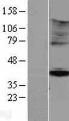 Western Blot: KIR5.1 Overexpression Lysate (Adult Normal) [NBP2-05201] Left-Empty vector transfected control cell lysate (HEK293 cell lysate); Right -Over-expression Lysate for KIR5.1.