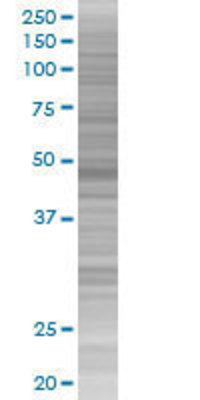 KRT16 transfected lysate.