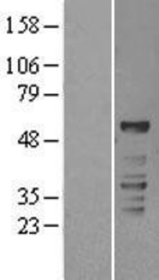 Western Blot: ROR gamma Overexpression Lysate (Adult Normal) [NBL1-15482] Left-Empty vector transfected control cell lysate (HEK293 cell lysate); Right -Over-expression Lysate for ROR gamma.