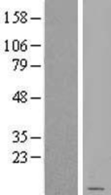 Western Blot: SDHD Overexpression Lysate (Adult Normal) [NBL1-15768] Left-Empty vector transfected control cell lysate (HEK293 cell lysate); Right -Over-expression Lysate for SDHD.