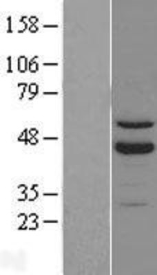 Western Blot: ROR beta Overexpression Lysate (Adult Normal) [NBL1-15481] Left-Empty vector transfected control cell lysate (HEK293 cell lysate); Right -Over-expression Lysate for ROR beta.