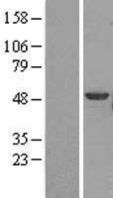 Western Blot: Brk Overexpression Lysate (Adult Normal) [NBL1-14954] Left-Empty vector transfected control cell lysate (HEK293 cell lysate); Right -Over-expression Lysate for Brk.