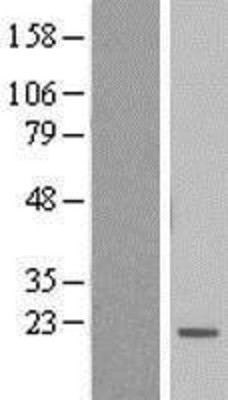 Western Blot: BTF3L4 Overexpression Lysate (Adult Normal) [NBL1-08046] Left-Empty vector transfected control cell lysate (HEK293 cell lysate); Right -Over-expression Lysate for BTF3L4.