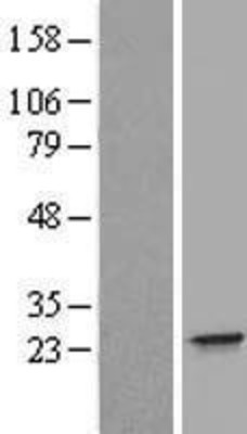 Western Blot: IFNA21 Overexpression Lysate (Adult Normal) [NBL1-11843] Left-Empty vector transfected control cell lysate (HEK293 cell lysate); Right -Over-expression Lysate for IFNA21.