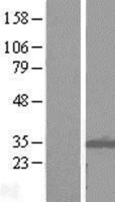Western Blot: ITM2B Overexpression Lysate (Adult Normal) [NBL1-12082] Left-Empty vector transfected control cell lysate (HEK293 cell lysate); Right -Over-expression Lysate for ITM2B.