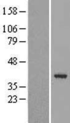 Western Blot: JAB1 Overexpression Lysate (Adult Normal) [NBL1-09383] Left-Empty vector transfected control cell lysate (HEK293 cell lysate); Right -Over-expression Lysate for JAB1.