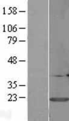 Western Blot: Calmodulin 3 Overexpression Lysate (Adult Normal) [NBL1-08651] Left-Empty vector transfected control cell lysate (HEK293 cell lysate); Right -Over-expression Lysate for Calmodulin 3.