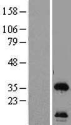 Western Blot: HSU79274 Overexpression Lysate (Adult Normal) [NBL1-08130] Left-Empty vector transfected control cell lysate (HEK293 cell lysate); Right -Over-expression Lysate for HSU79274.