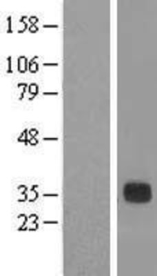 Western Blot: DCUN1D3 Overexpression Lysate (Adult Normal) [NBL1-09757] Left-Empty vector transfected control cell lysate (HEK293 cell lysate); Right -Over-expression Lysate for DCUN1D3.
